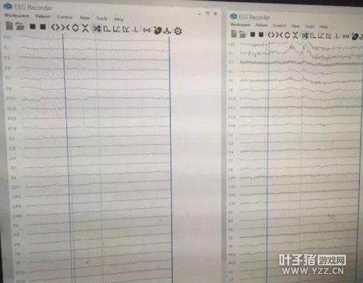 �ⶥ300000�ġ�ñ�ӡ� ���LPL�����ɹ��ķ�����