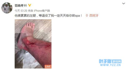 ����������Ѫ���߰ߣ�������⣺�Ҹ�����sp